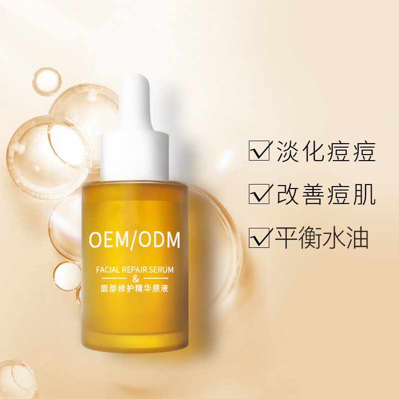 大渡口区_祛痘精华原液OEM